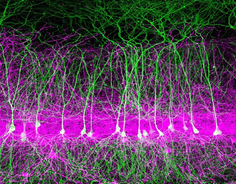 In the brain, parvalbumin interneurons (magenta) potently inhibit pyramidal neurons in the hippocampus (green) by forming strong synapses with their cell bodies and dendrites. Imaged by array tomography, courtesy of Erik Bloss.