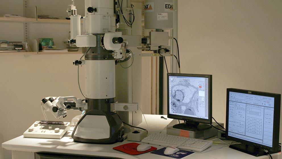 JEOL 1230 TEM resize