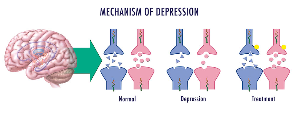 https://media.jax.org/m/1f0ce42cfe433a22/original/mechanism-of-depression.jpg?utm_source=chatgpt.com