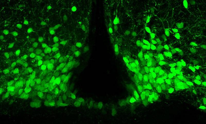 Exploring brain plasticity with single-cell precision - Page Tile 2