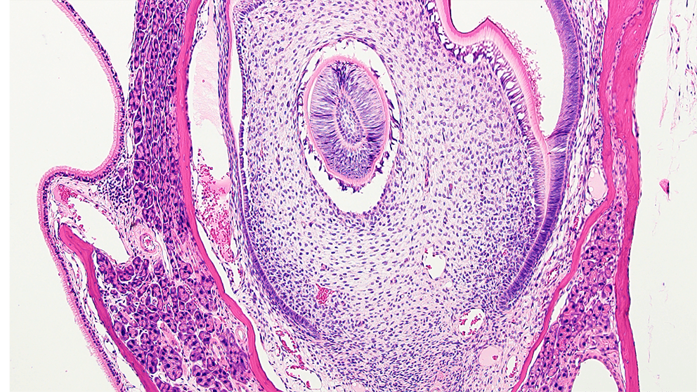 H&E normal tooth resize