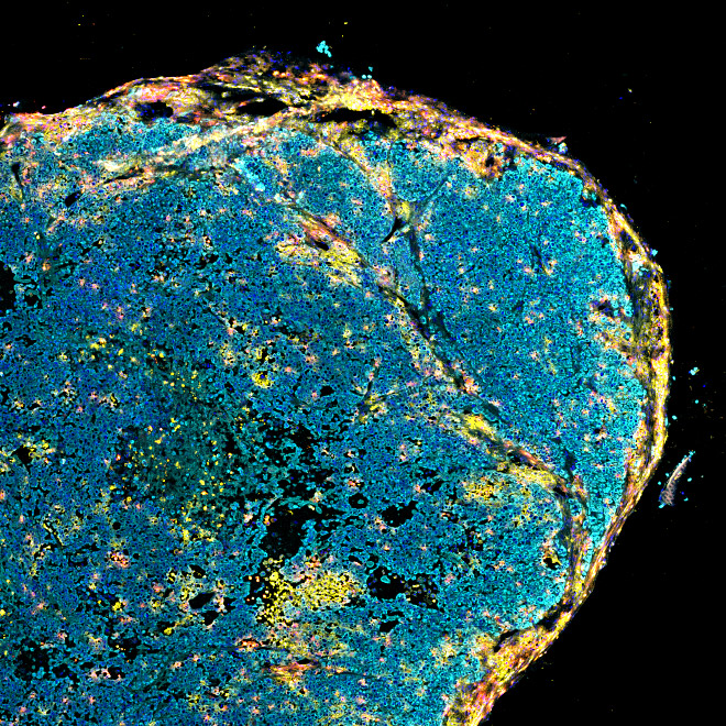 The Jackson Laboratory Cancer Center Shared Resources