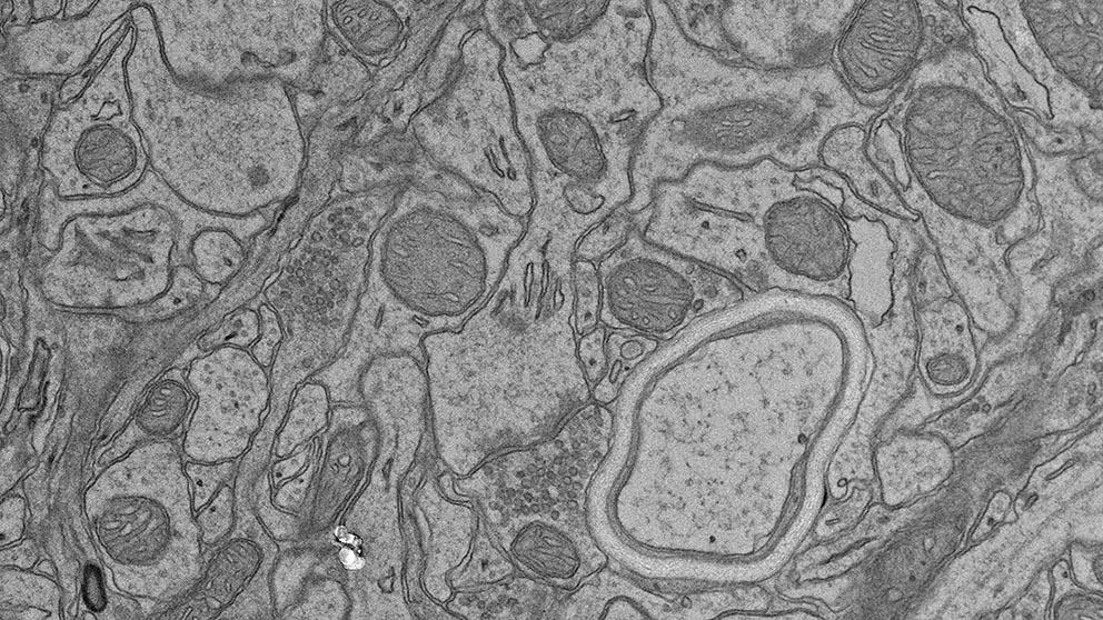 TEM - synapse nice resize