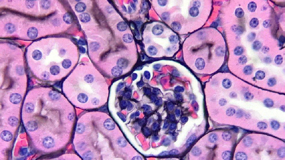 Jones Stain + H&E- Kidney Glomerulus resize