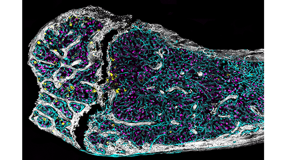 【ぴお】DIR / [THE MARROW OF A BONE] Blu Bone Marrow Pathology: 9781394244812: Medicine & Health
