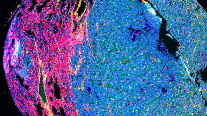 Using Tissue AI to map the future of cancer research