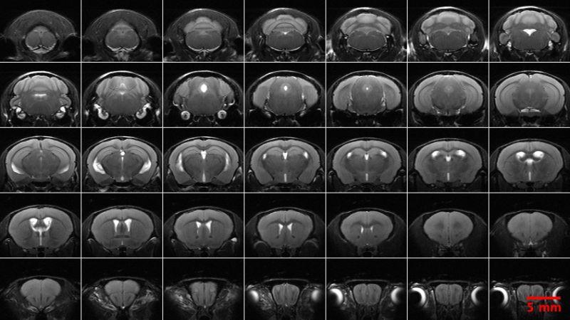 CBA_1 Anatomical NeuroMRI_800x450 - 1