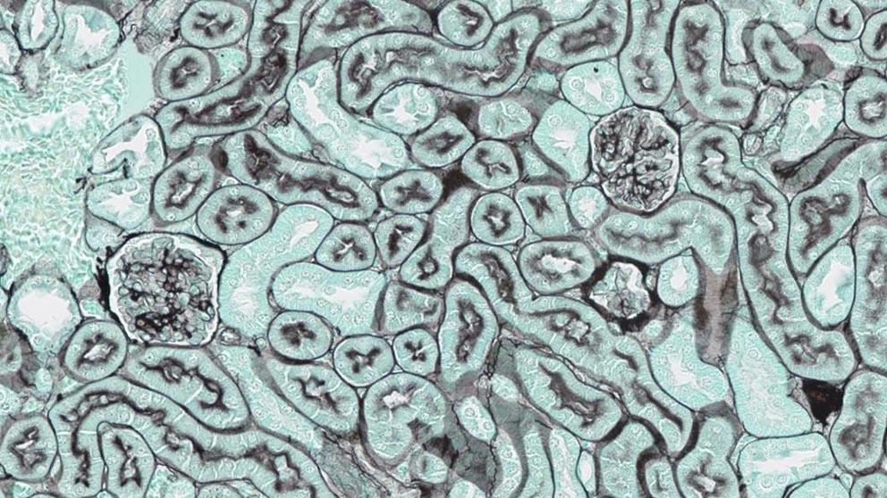 Kidney with Silver Stain resize