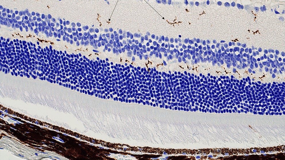 IHC - Iba1 retina resize