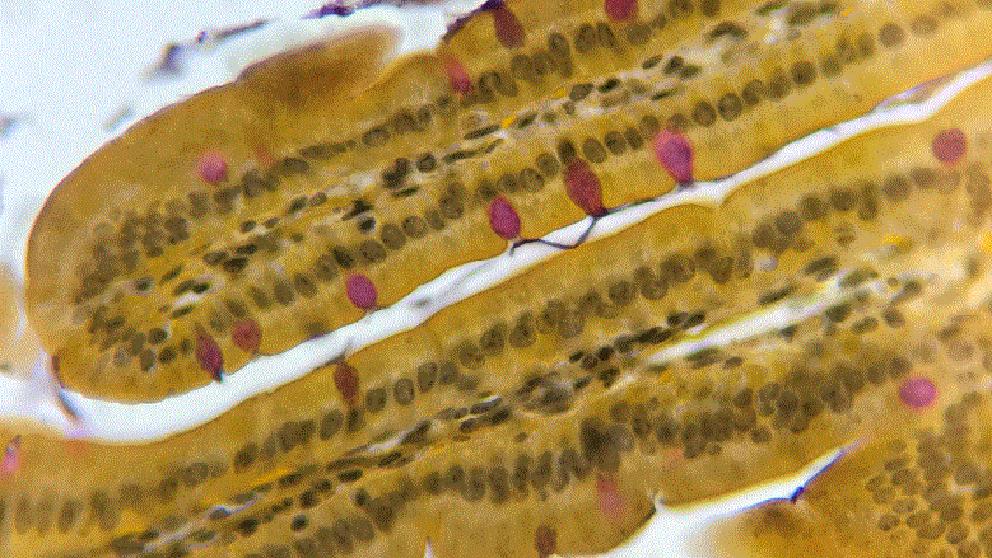 Mucicarmine on Intestines resize