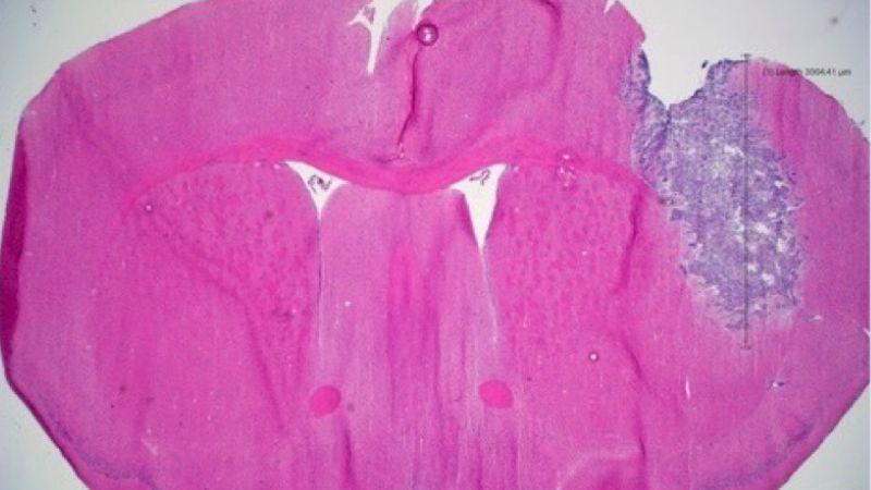 XLIS_Figure A_800x450 - 1