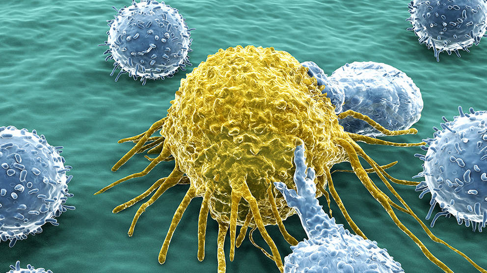 The Next 'Big Thing' in Cancer Modeling: Patient-Derived