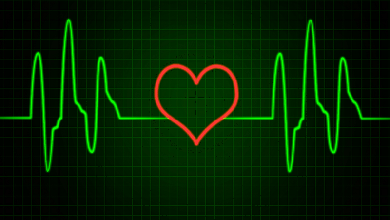 heart_rhythm