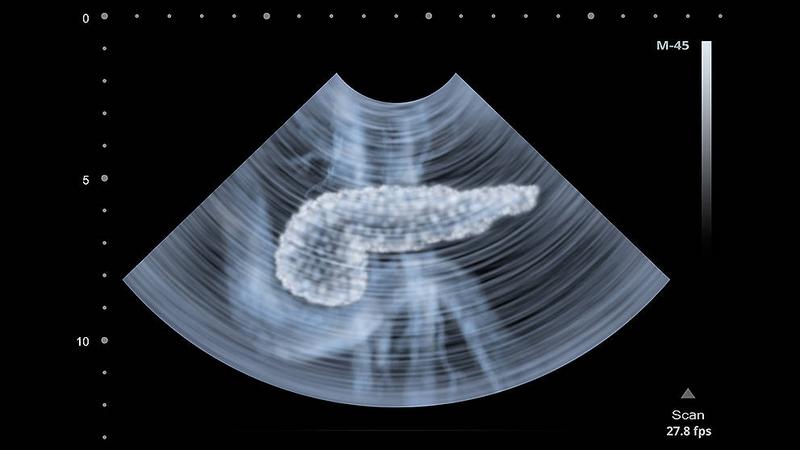 pancreas