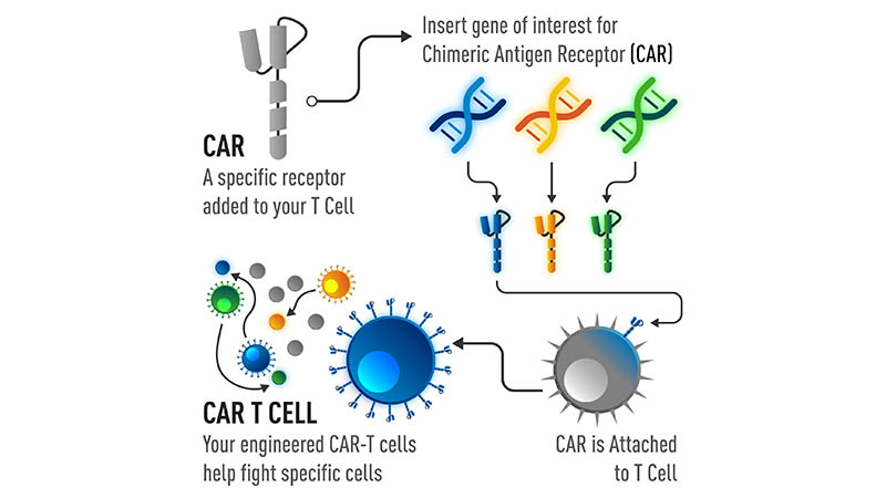 Using JAX lupus phenotype models to assess CAR-T therapy