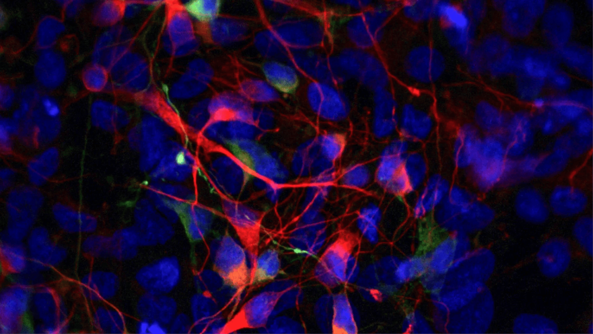 Understanding Passage Limits and iPSC Cell Line Consistency