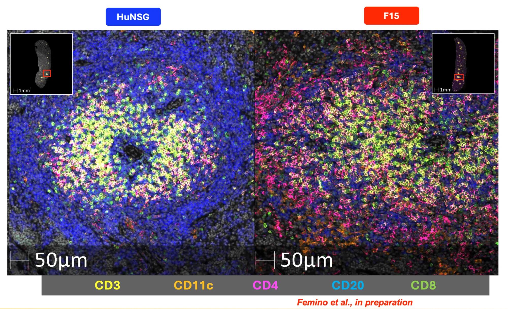 Figure 2: Immune complexity differs significantly between models. Enlarged view of one of the above foci, showing the diversity of cells present in the Hu-F15 model