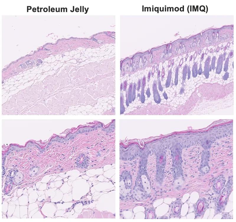 Figure 2. Histopathological evaluation in skin from Imiquimod-induced psoriasis.