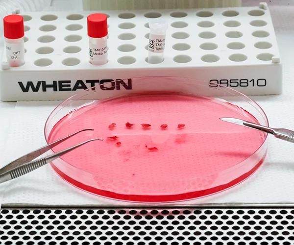 The Jackson Laboratory - PDX Biospecimens