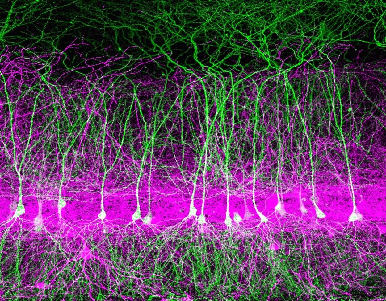 Neuroscience