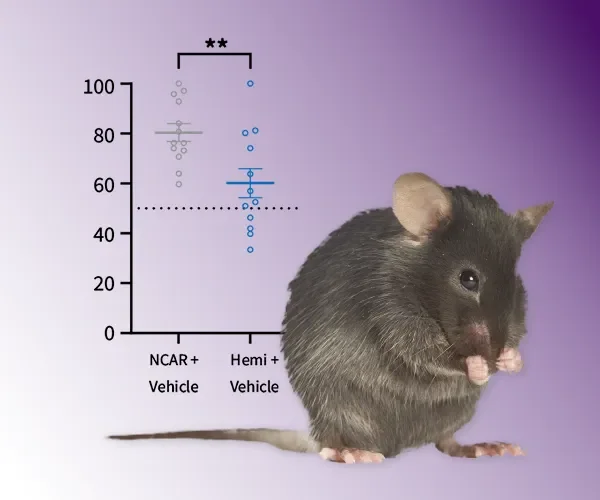 Alzheimer’s Models