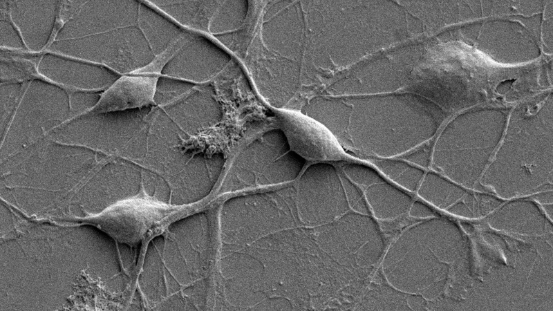 Stem cell ‘toolkit’ to shine light on the mysteries of Parkinson’s disease - Page Tile - News