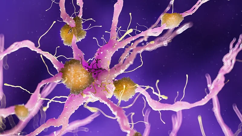 New analysis offers most comprehensive roadmap for targeted Alzheimer's research