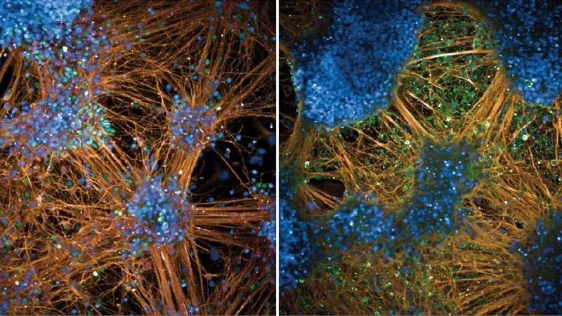 Researchers make mice a more powerful tool to study a wide range of human diseases