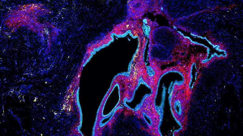 1 in 10: The endometriosis challenge - Page Tile