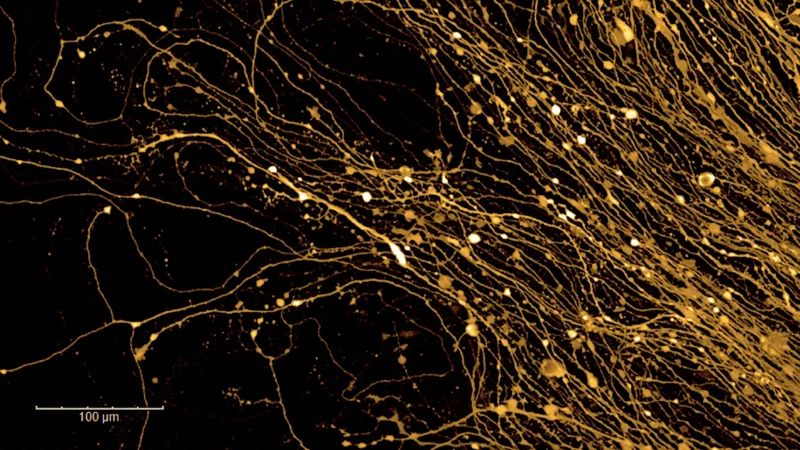 *Parkinson’s Disease - page tile
