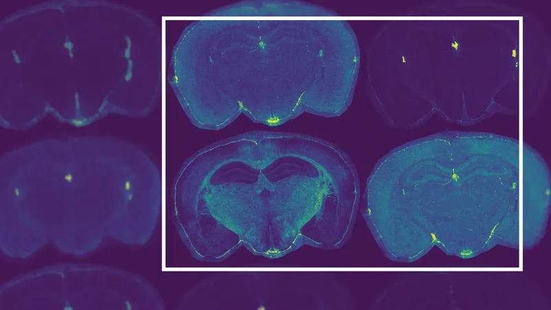*A new model for late-onset Alzheimer’s