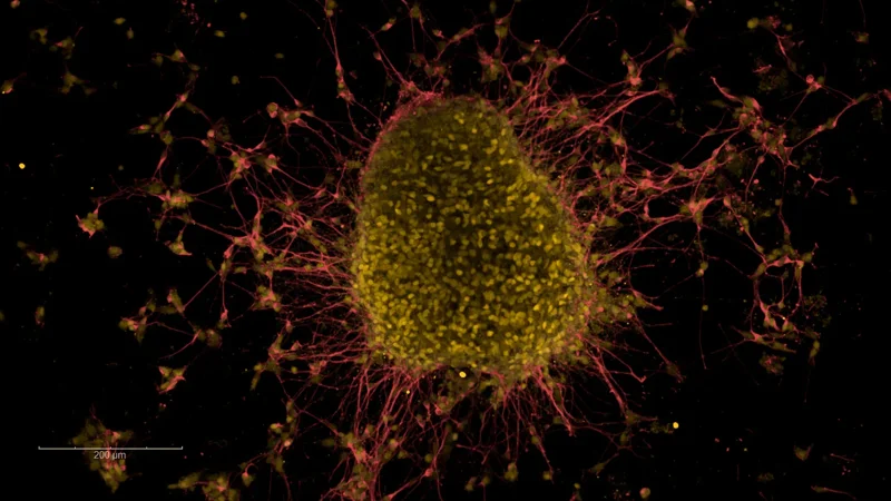 A $4.6 million effort to build standardized stem cell models for Parkinson's disease - Page Tile - News Release