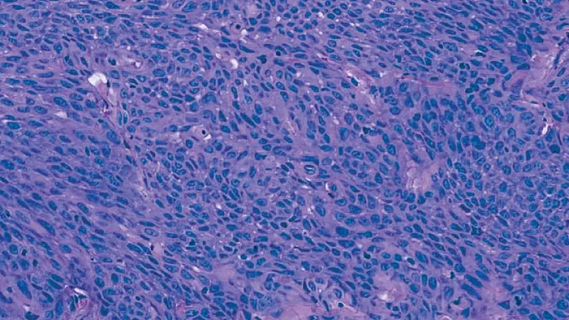 Patient-Derived Xenograft (PDX) Models - Tile