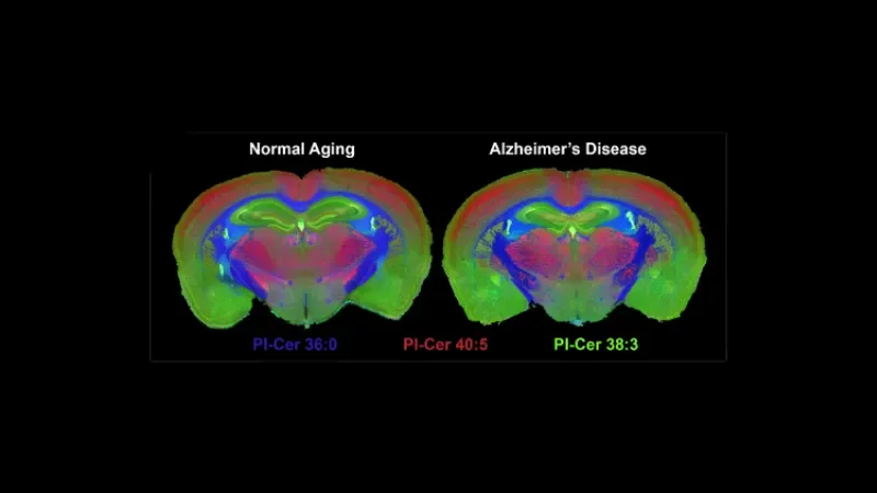 Exploring brain plasticity with single-cell precision - Page Tile
