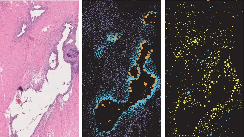 *A closer look at endometriosis pain: New map reveals key cellular interactions - page tile