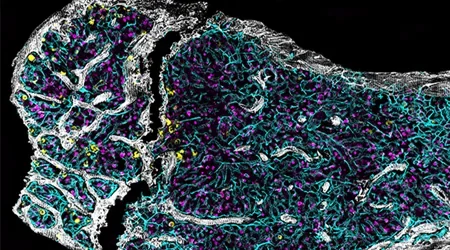 How old is your bone marrow?