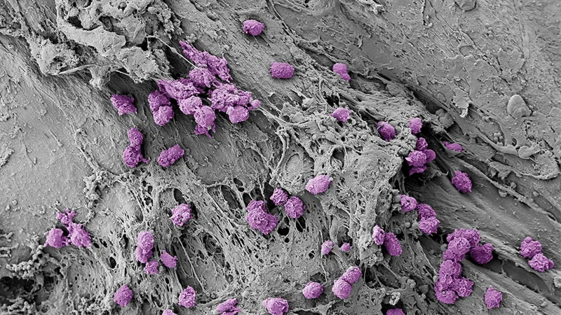 Painless skin patch offers new way to monitor immune health - Page Tile 1