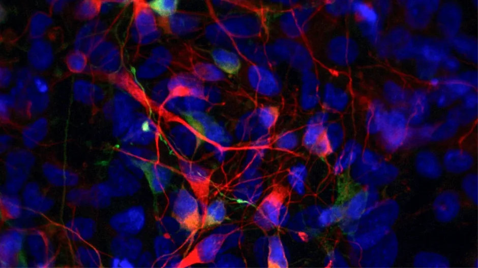 Understanding Passage Limits and iPSC Cell Line Consistency