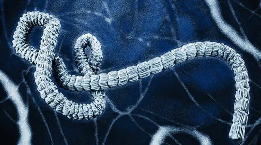 An Update: Trends in Ebola Research