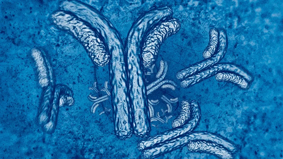 Exploring autoimmune neuritis associated with type 1 diabetes