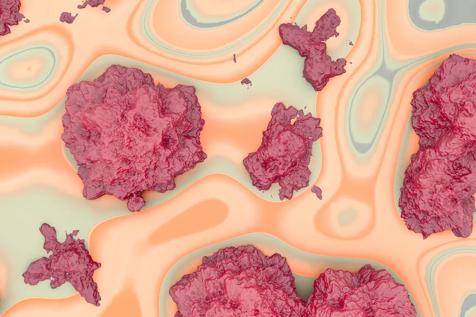 Fueling cancer metastasis