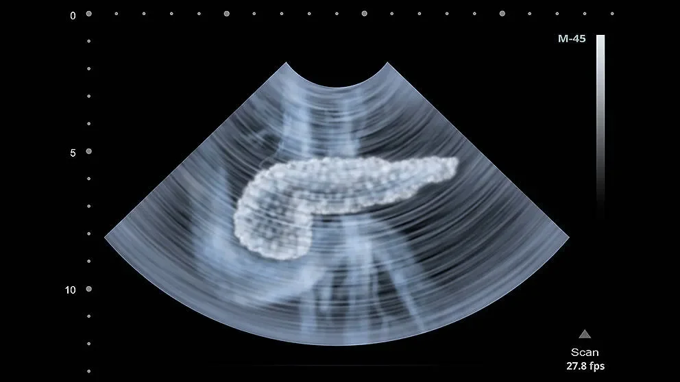 Single-cell analyses promise insights into pancreatic cell function, diabetes