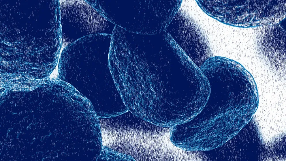 Acute myeloid leukemia: using patient-derived xenografts to grapple with disease complexity