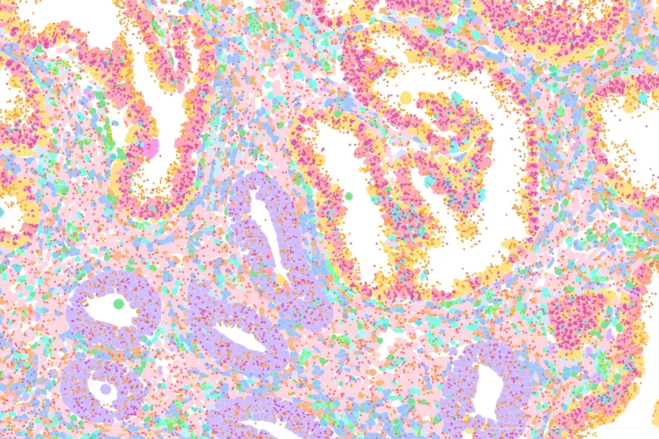 Endometrium biopsies collected and processed by Jessica Cheung and Joshua Lee in the Courtois Lab.