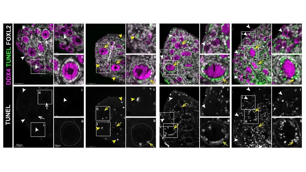 Revealing a master regulator of cancer treatment-induced ovarian failure