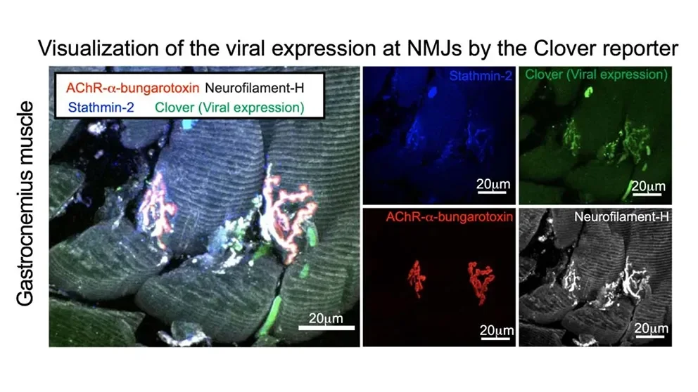 Important new insights for ALS