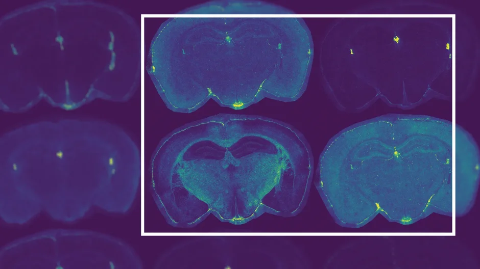 Brain scans of a mouse. Imaged by Surjeet Singh, Ph.D.