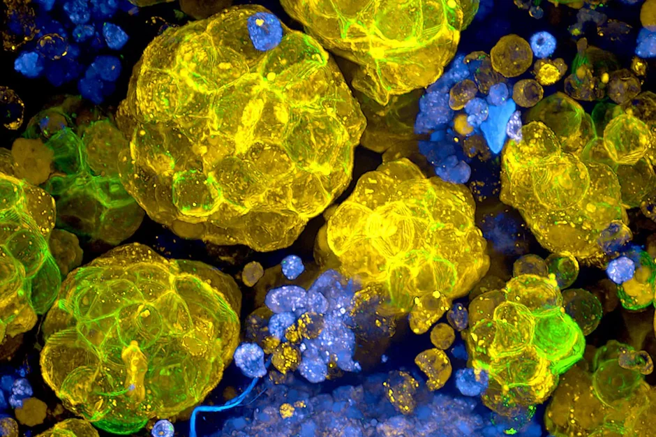 Dark-field microscope image of human colon tumor organoids grown at JAX and imaged in the Single Cell Biology Laboratory. 