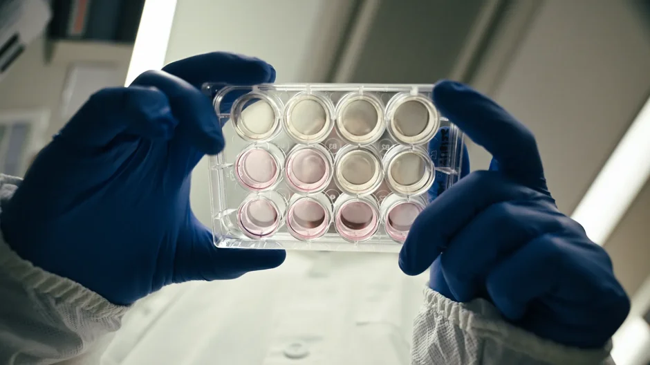 A scientific researcher holds induced pluripotent stem cells (iPSCs) in the lab at the JAX-NYSCF Collaborative in New York. A new grant from the Michael J. Fox Foundation will help transform Parkinson’s research by supporting work into how the GBA1 gene functions in cells.