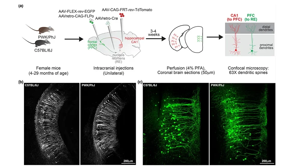 Sharp as a tack or vague and forgetful?